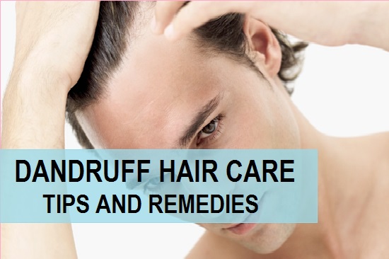 Dandruff Care Tips for Men Methods, Remedies for Dandruff Removal