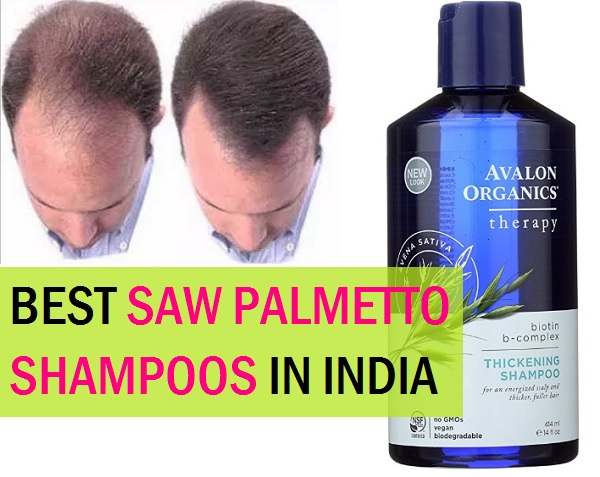 Best Saw Palmetto Shampoos in India