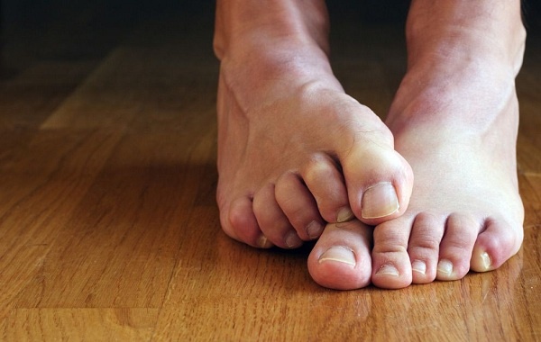 homeremedies for mens smelly feet